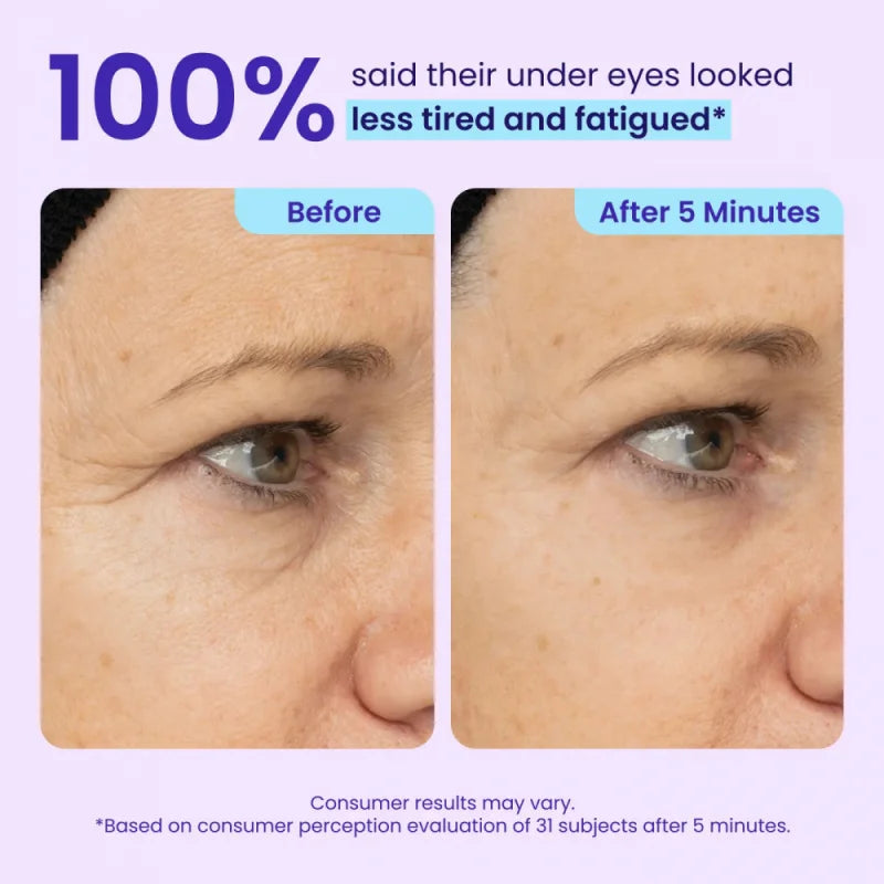 Glowré Instant Lift Eye Gel